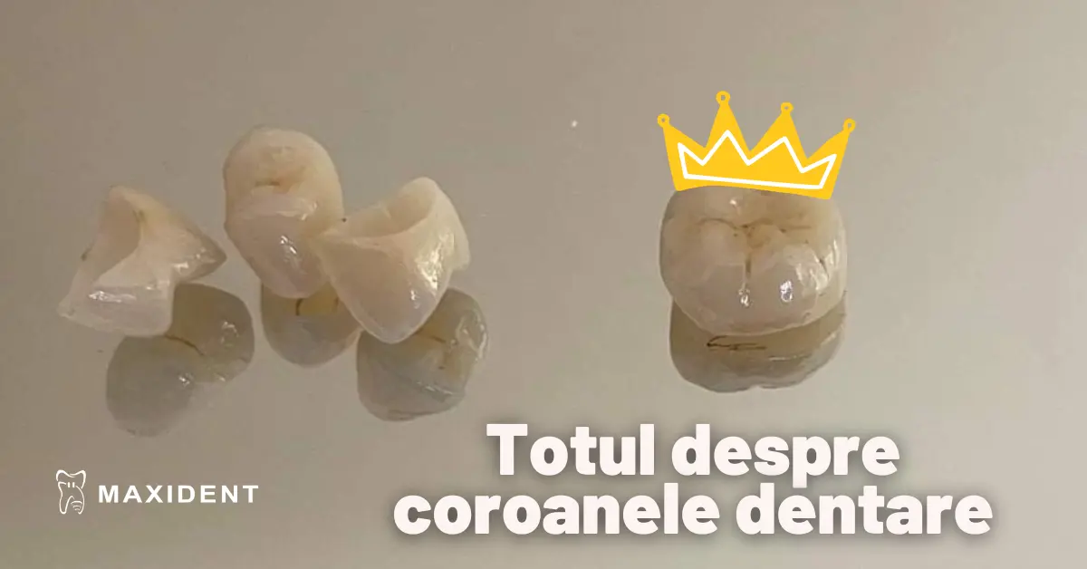coroane dentare iasi